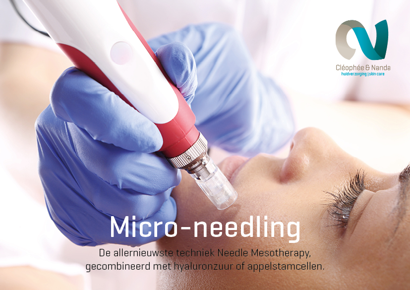 Micro needling